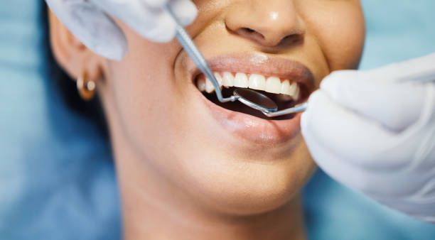 Best Emergency Tooth Extraction in Conway, AR